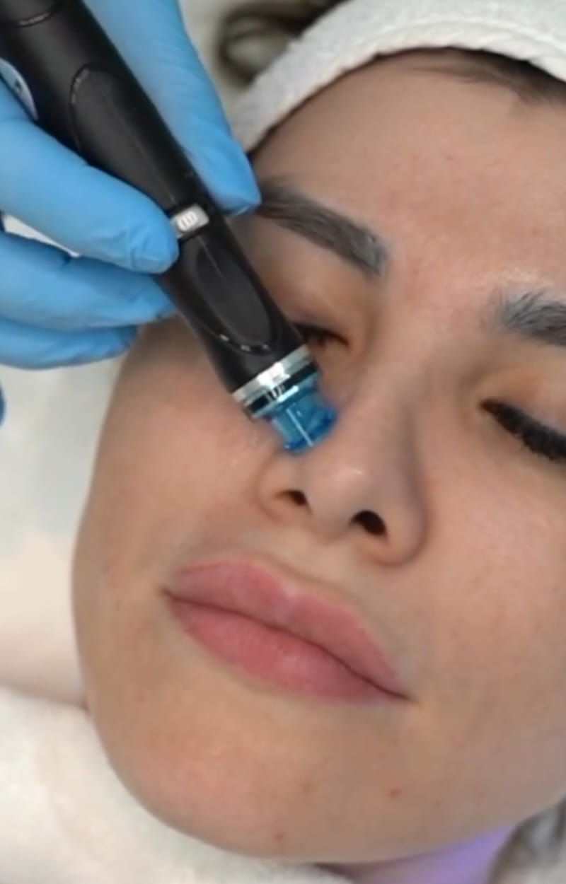 Hydrafacial In Abu Dhabi Best Hydrafacial Skin Clinic