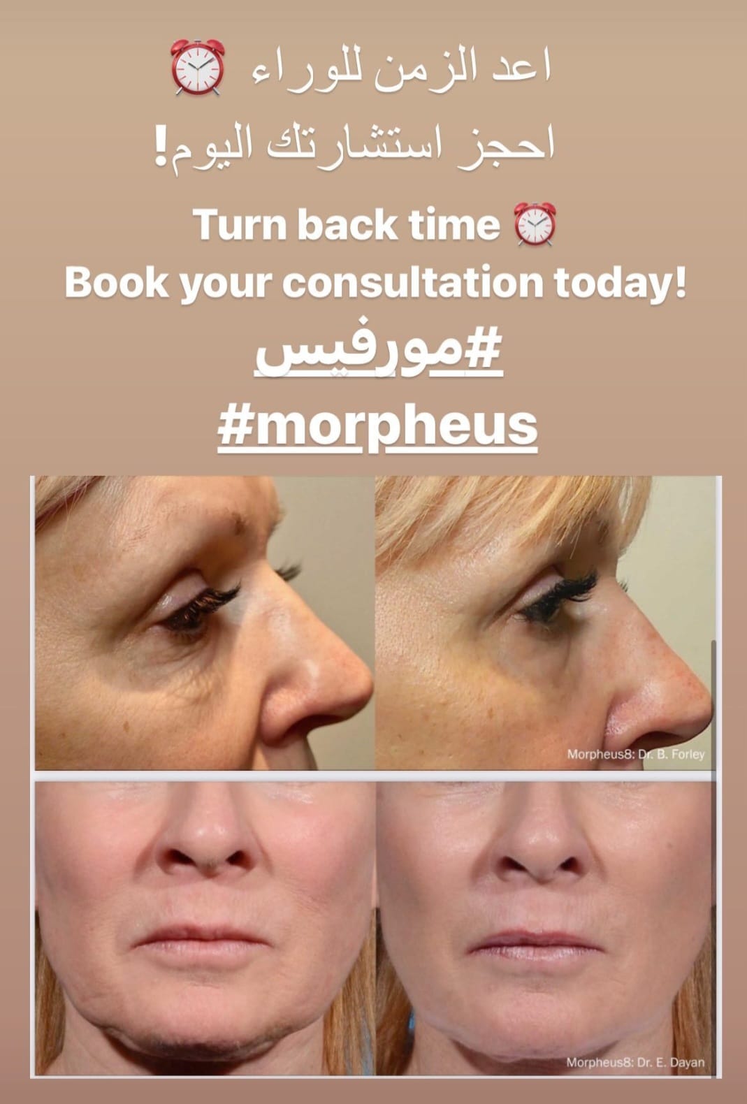 Book Your Morpheus8 Session In Skin Institute Clinic Abu Dhabi