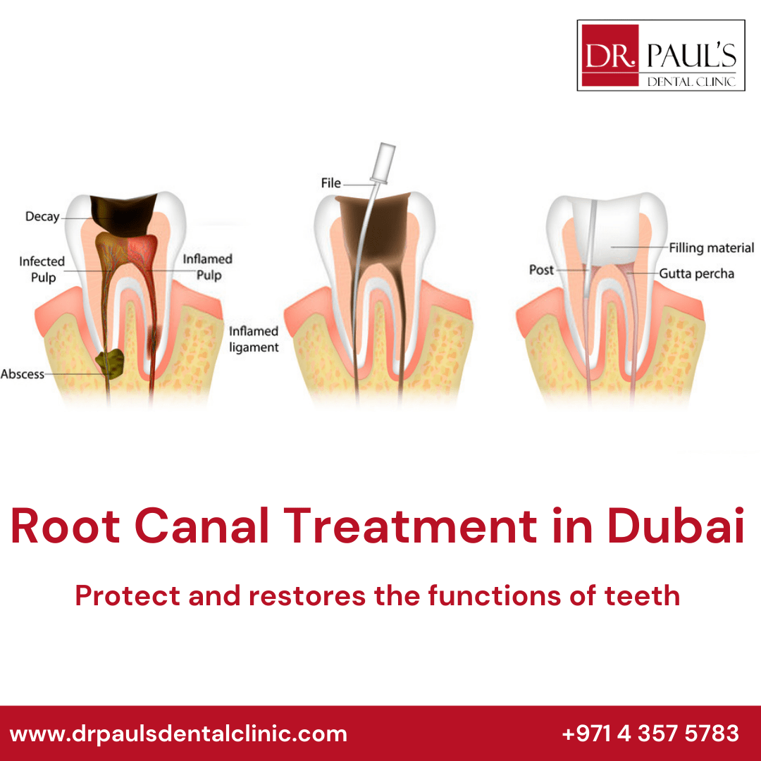 Specialist Endodontist In Dubai