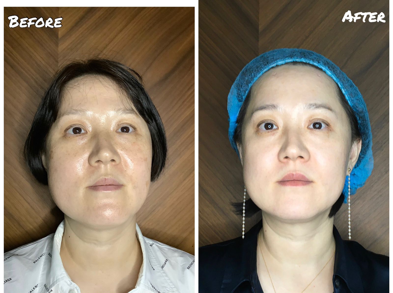 Skin Clinic Abu Dhabi Dermatologist Laser Hair Removal Abu Dhabi