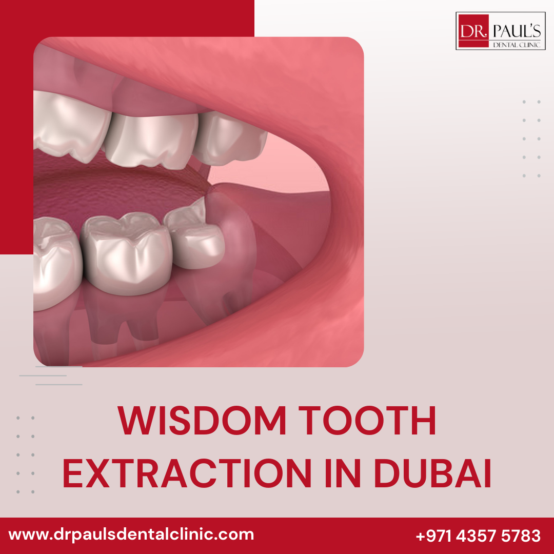 Wisdom Tooth Extraction In Dubai